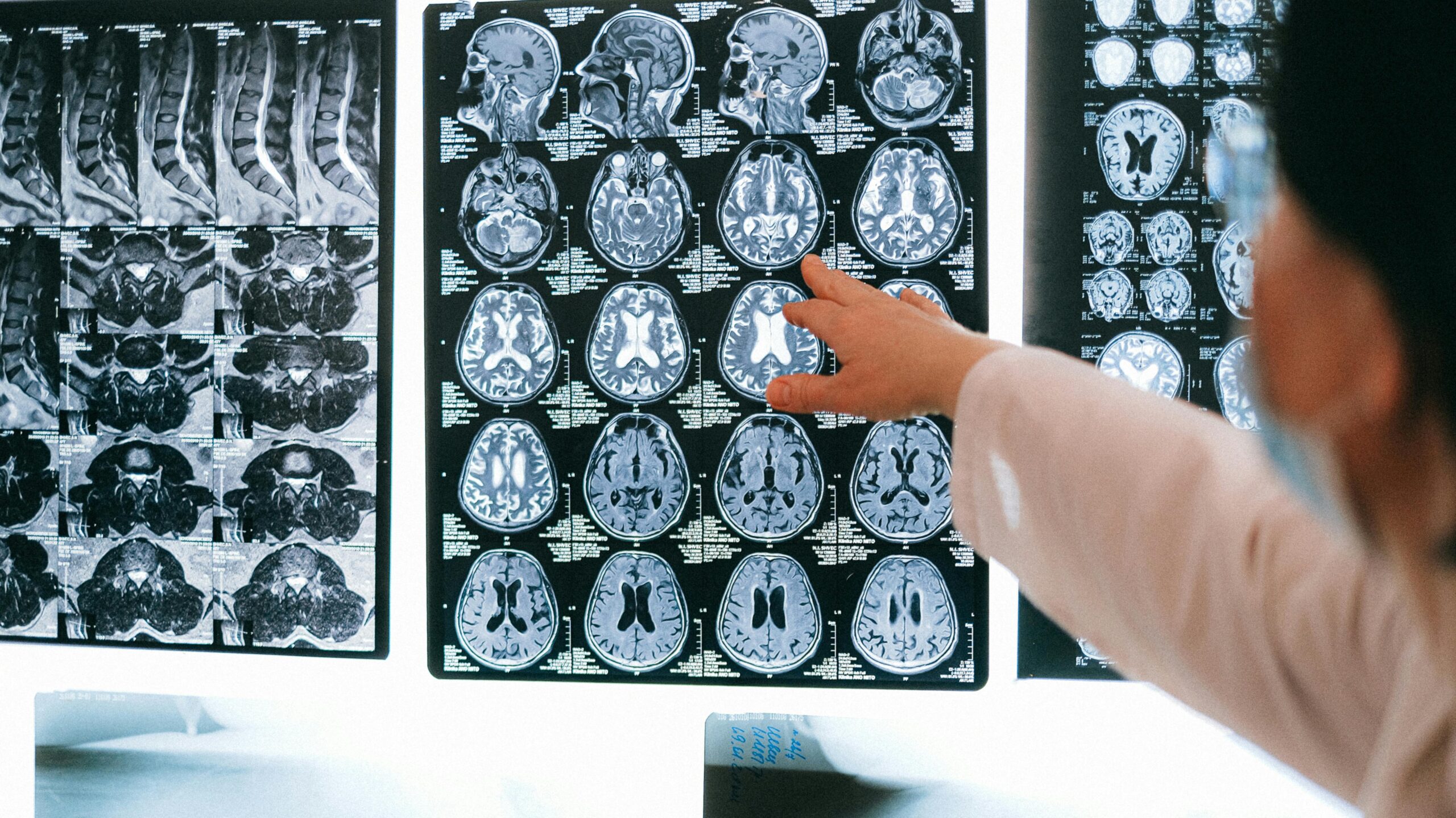 A landmark German brain-imaging study found that heavy pornography use weakens self-control and rewires the brain’s reward system. Discover how faith and neuroscience offer real recovery.